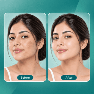 UK's Derma client glowing skin results